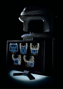 3D - Röntgen / Digitale Volumentomographie (DVT)